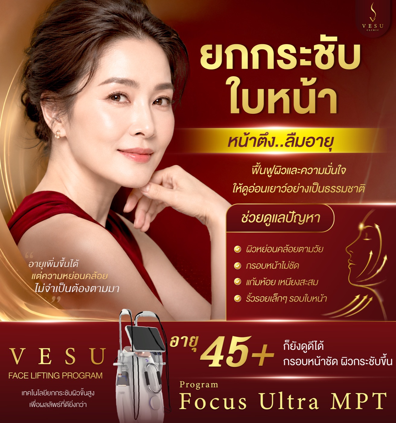 Focus Ultra MPT ยกกระชับใบหน้า — VESU CLINIC เชียงใหม่