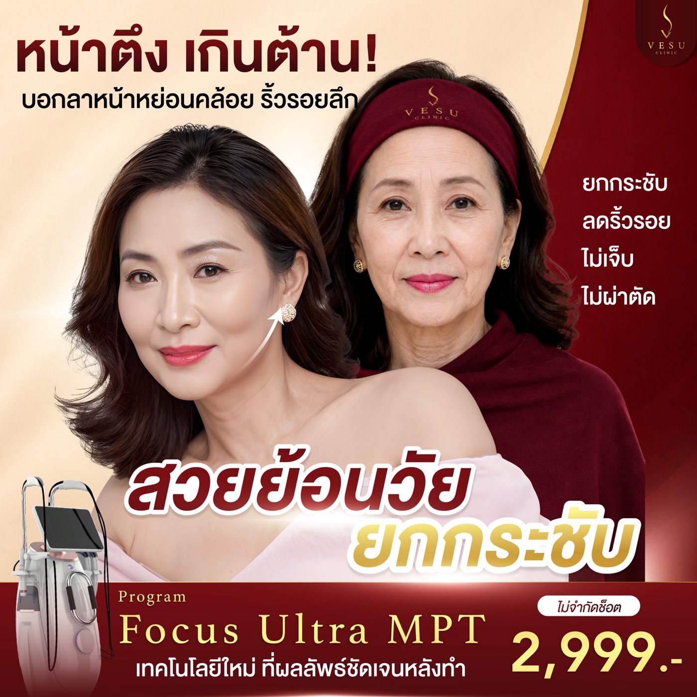 Focus Ultra MPT ภาพที่ 2